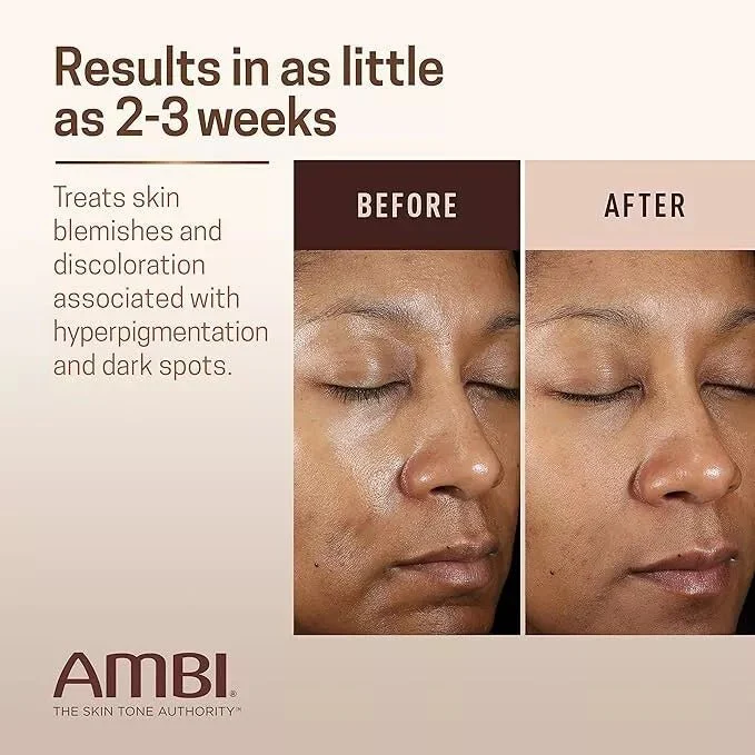 Ambi Even & Clear Fade Cream 1oz - 2 Variants - Hydroquinone-Free - Image 9