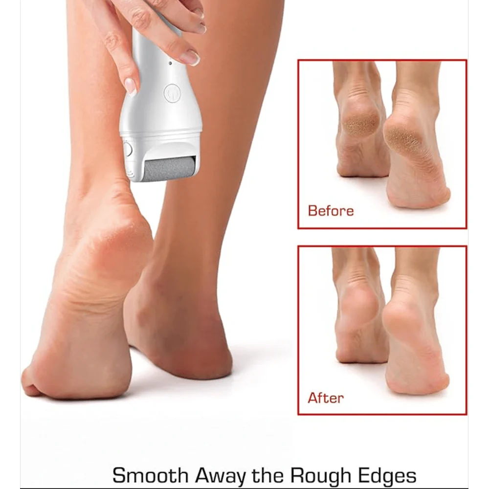 Red by Kiss Cordless Foot Callus Remover – 2-Hour Runtime - Image 2