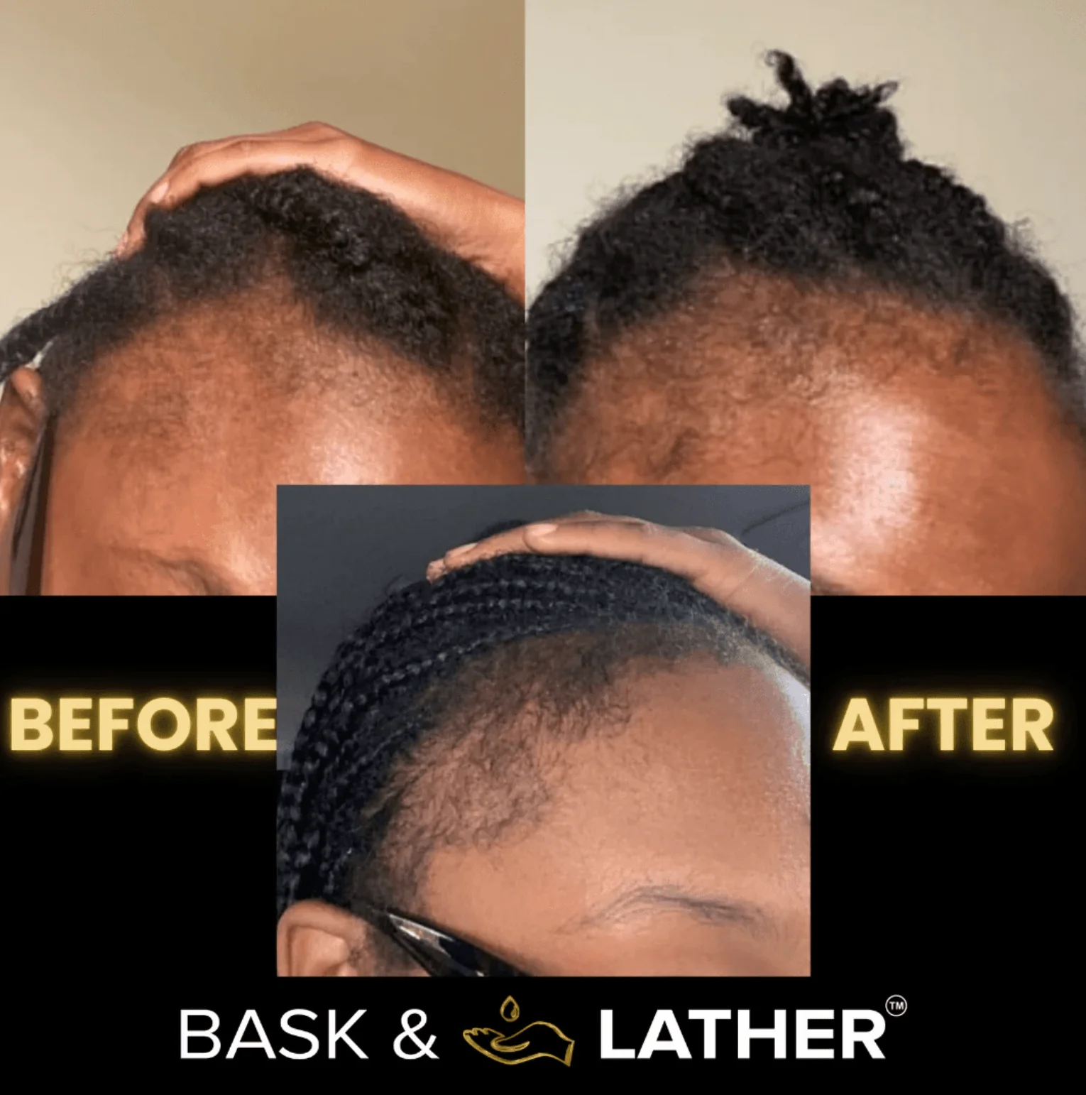 Bask & Lather Scalp Stimulator Hair Oil - Image 6