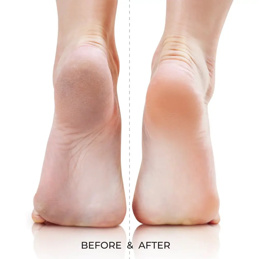 Kiss New York Dual-Sided Foot File – Ultra & Mega Buff - Image 13