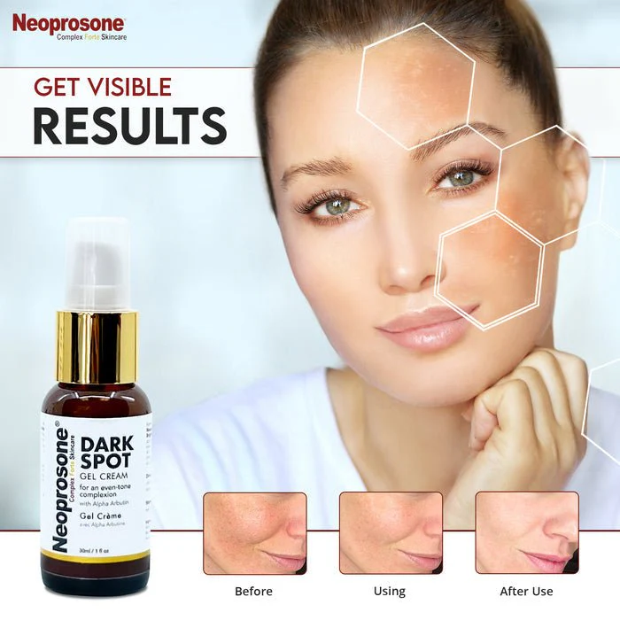 Mitchell Brands Neoprosone Gel Cream - 1oz - Image 4