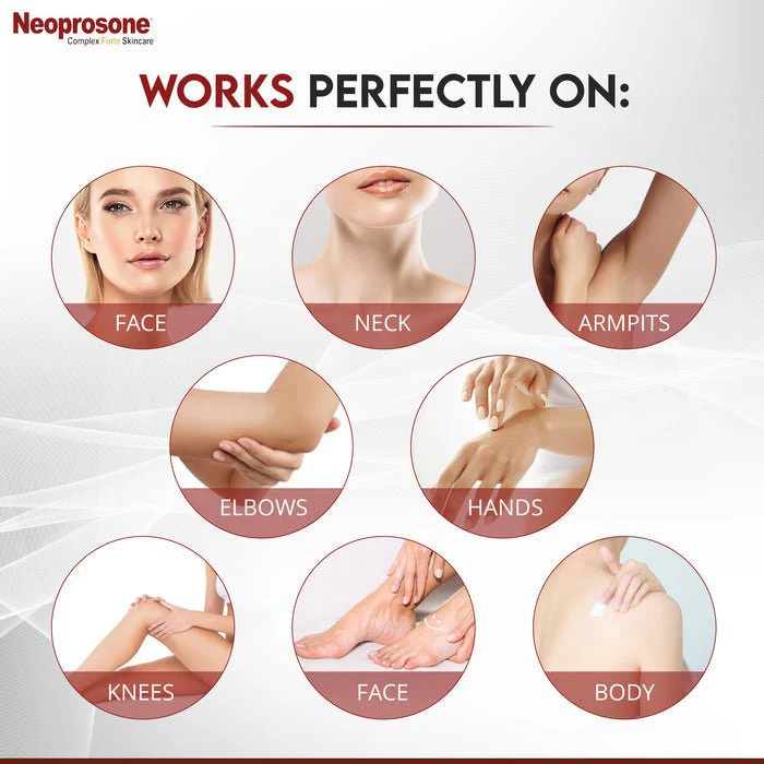 Mitchell Brands Neoprosone Gel Cream - 1oz - Image 7