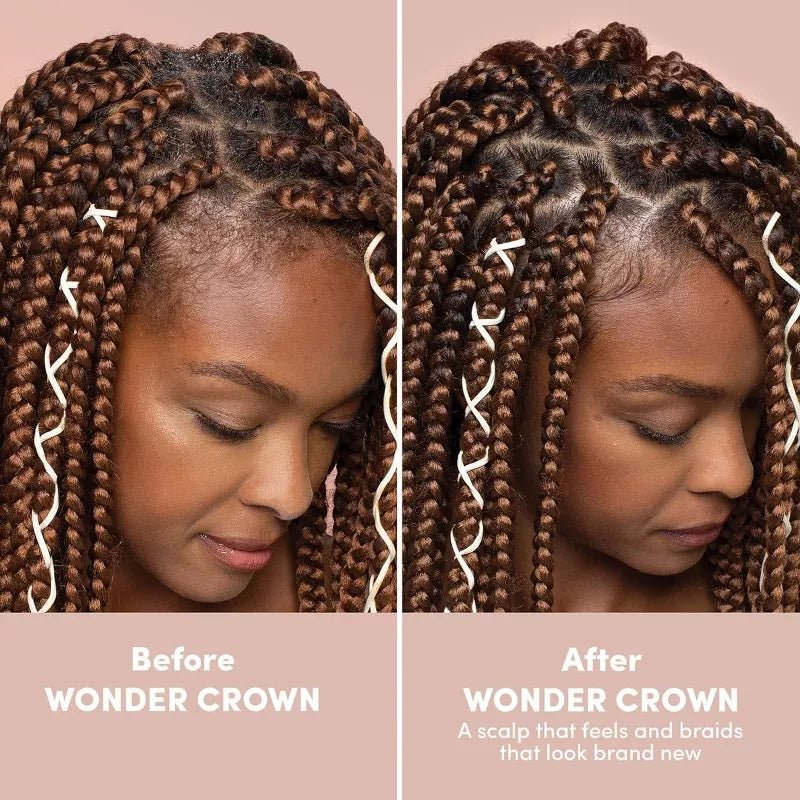 Mizani Wonder Crown Scalp Cleanser - Dry Scalp Treatment 6.8oz - Image 5