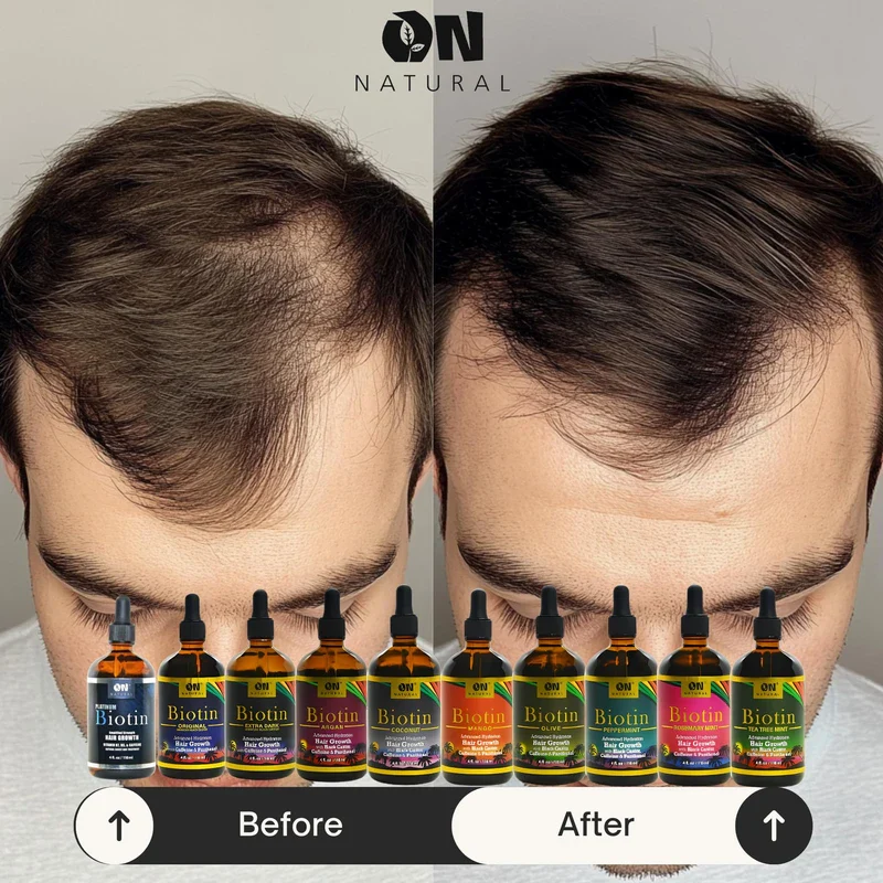 On Naturals Hair and Scalp Batana Oil - 4 oz - Image 3