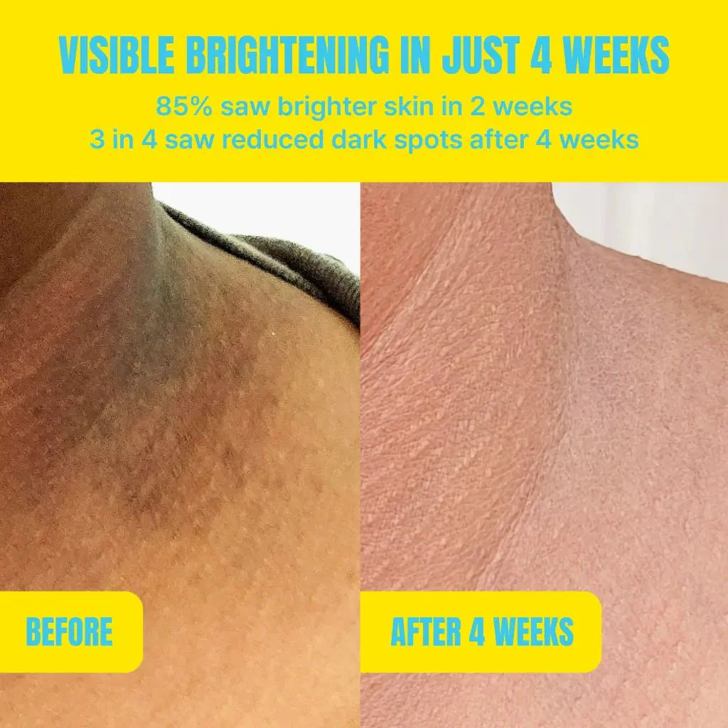 Red By Kiss Glow Up Body Wash Kojic Acid Vitamin C & Niacinamide - Image 4