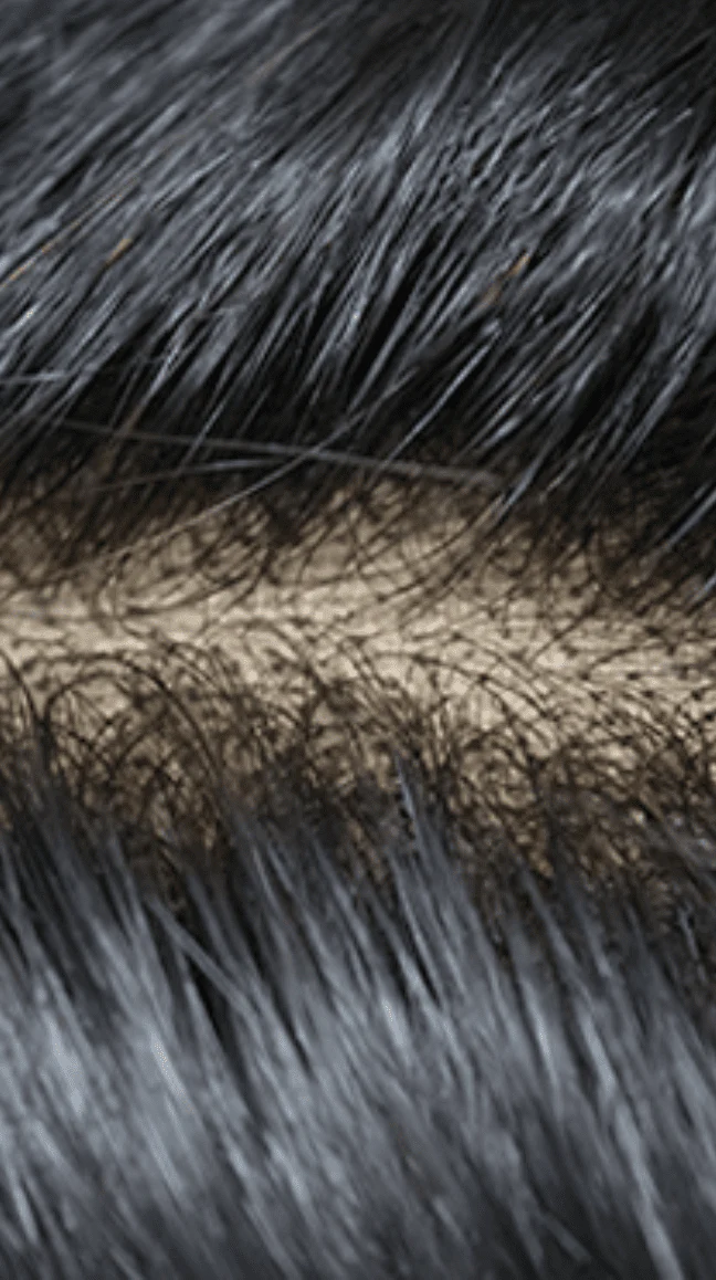 Rio Virgin Remy Human Hair Lace Closure β 5x5 - Image 4
