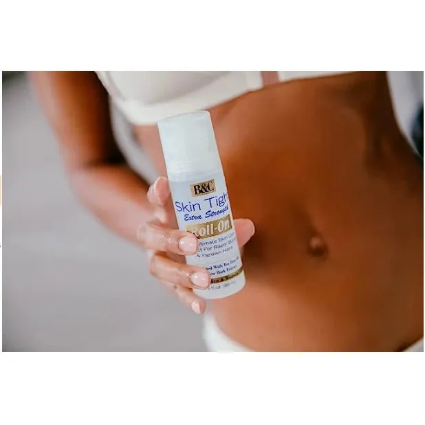Skin Tight Roll-On Formula – 3oz - Image 4